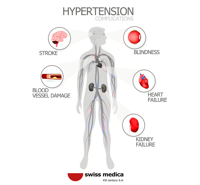 What causes hardening of the brain arteries and how is it treated?