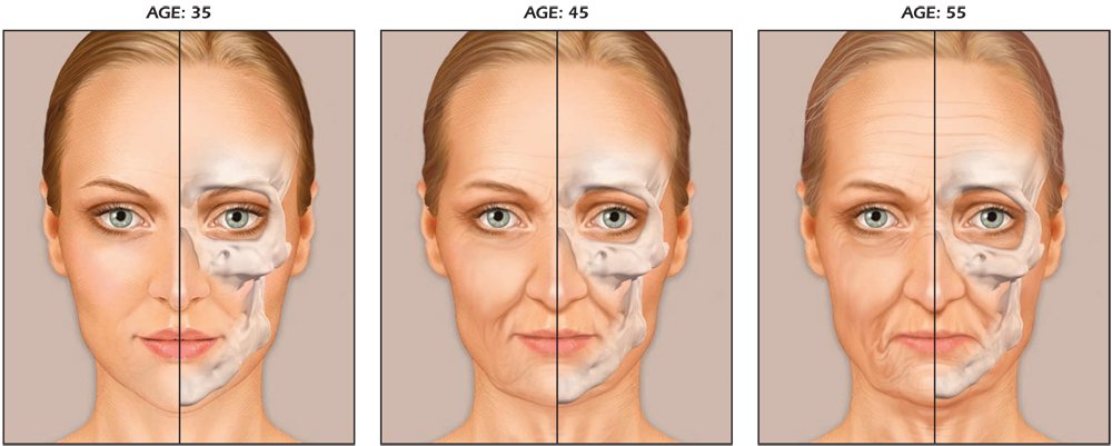 facial signs of aging russian sexy girls in minis porno