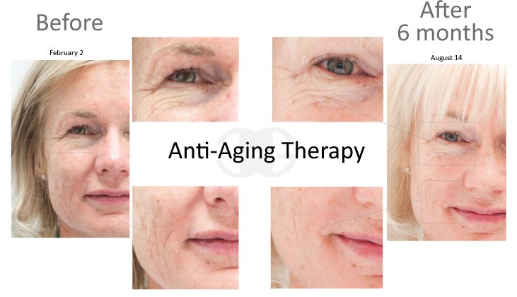 antiaging.jpg