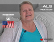 ALS stem cells treatment - Patient from the United States - Video
