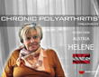 Polyarthritis stem cells treatment experience - Video