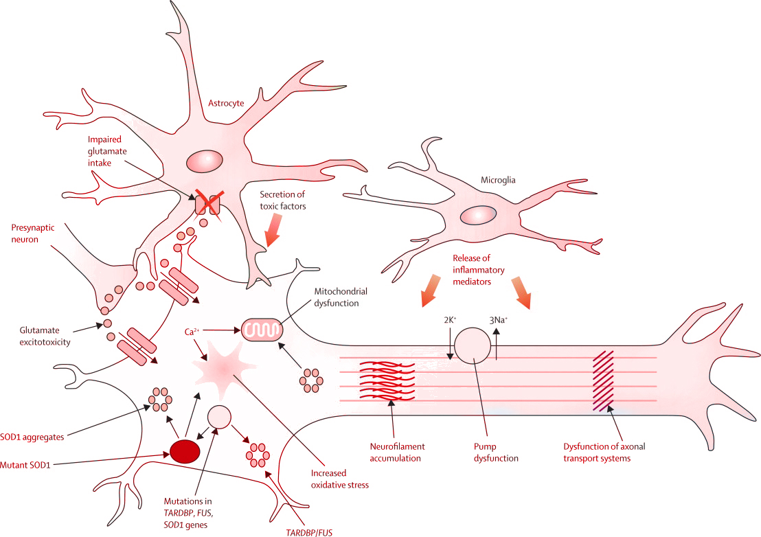 Amyotrophic lateral sclerosis processes