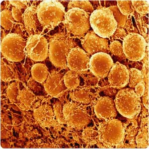 adipose tissue stem cells