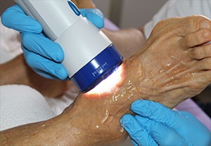 Spark-wave therapy
