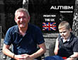 Stem Cell therapy for Autism