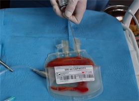Swiss Medica stem cells clinic for weight loss weight loss treatment clinic