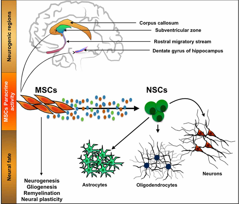 stem cell treatment for brain injury