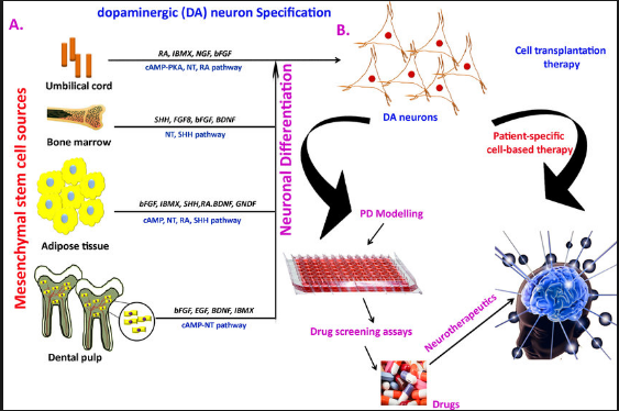 Parkinson's disease. Treatment with stem cells.