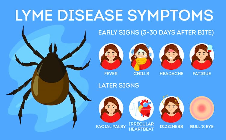 Sintomi della malattia di Lyme