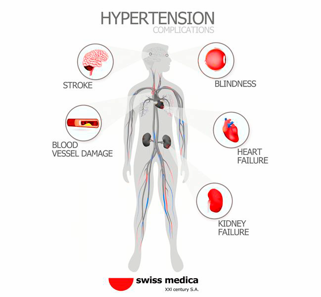 Terapia con cellule staminali per l’ipertensione