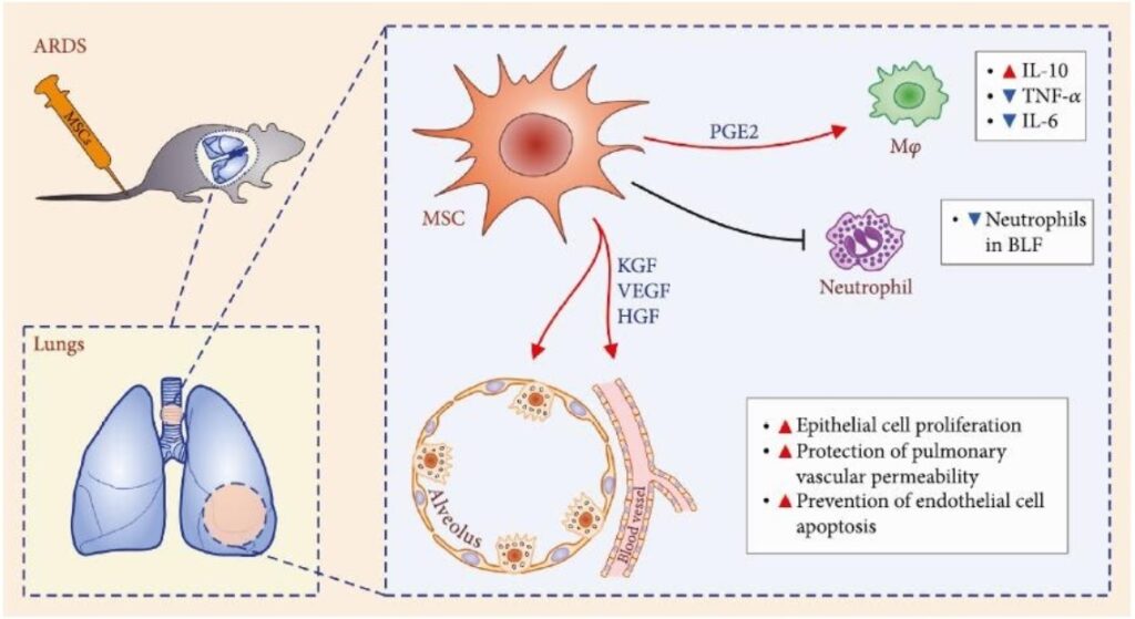 Potential of Mesenchymal stem cells (MSC) in Rehabilitation after Coronavirus COVID-19 and Treatment of its Complications such as Pulmonary Fibrosis