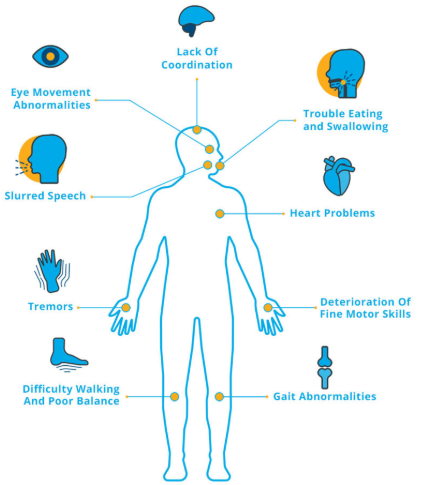 Stem Cell Treatment for Ataxia