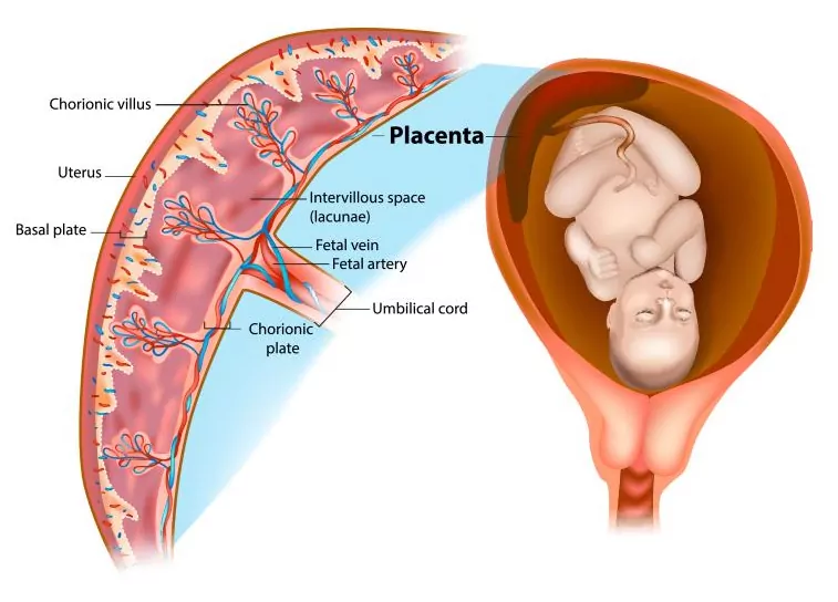 Treatment with Placental Stromal Cells