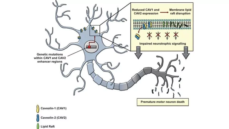 Trattamento con cellule staminali per la malattia del motoneurone (MND)