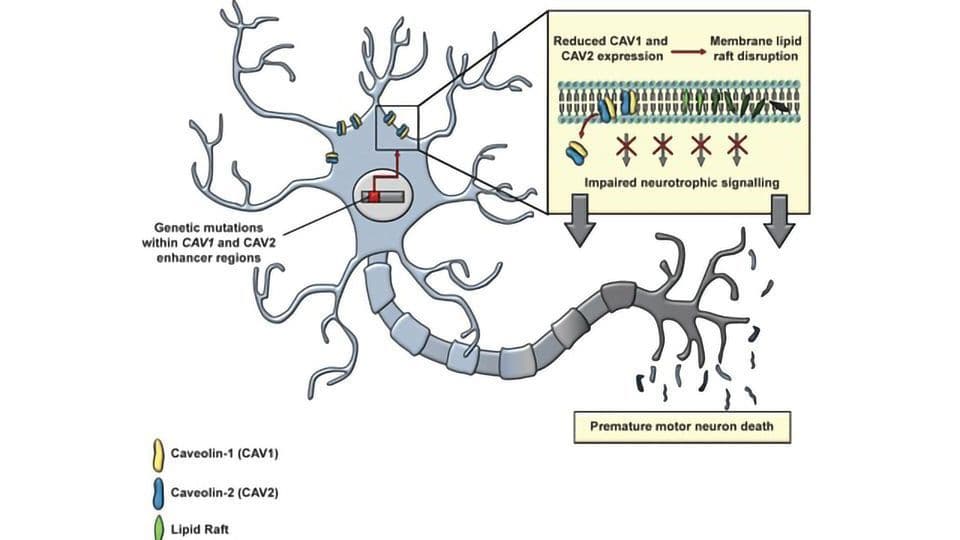 Stammzelltherapie für die Behandlung der Motoneuronenkrankheit (MND)