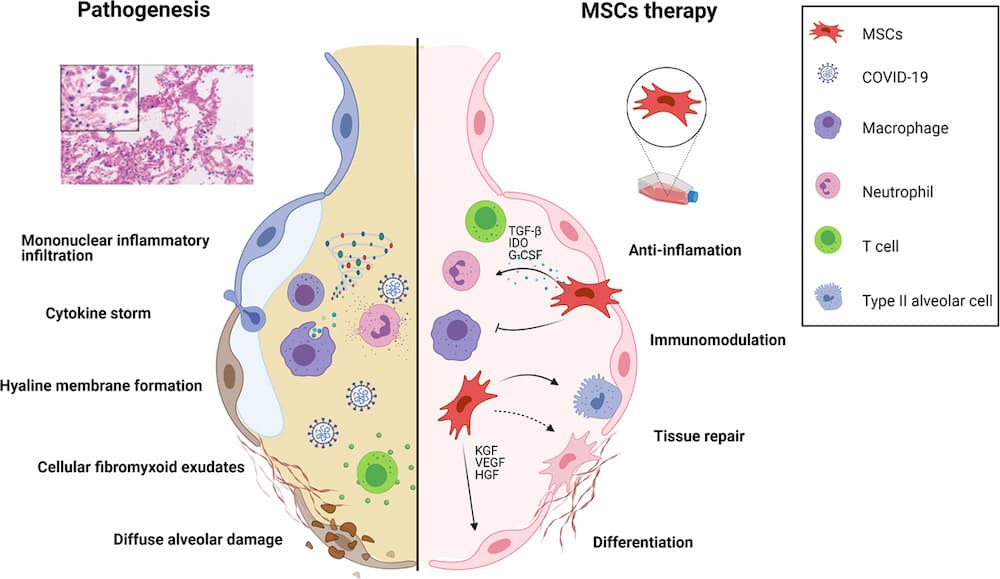 What Diseases Are Treated With Stem Cells?