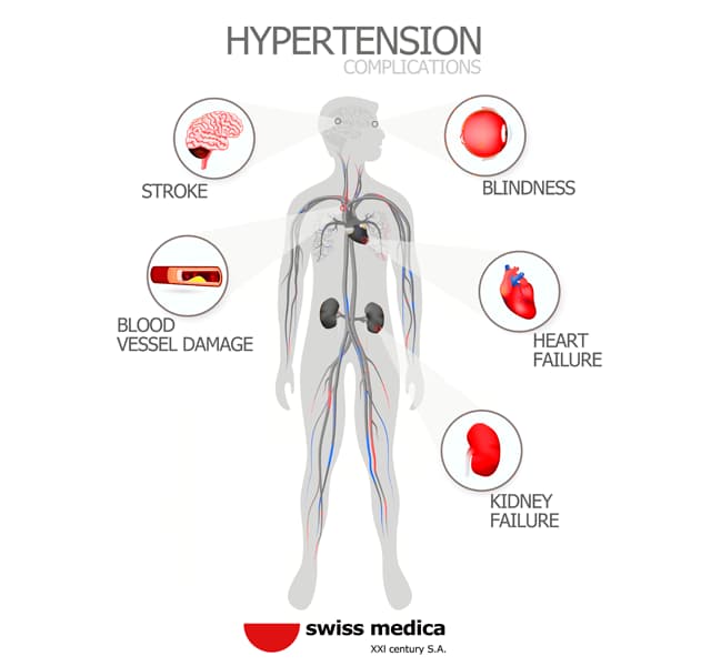 Infarction Treatment and Rehabilitation with Stem Cells