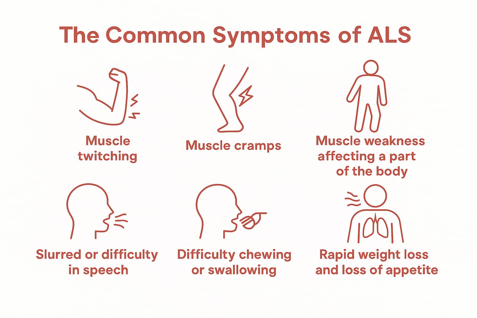 ALS Treatment with Stem Cells | Swiss Medica